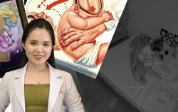 Bác sĩ: Có thể nghi ngờ trẻ bị bạo hành dựa vào sự kết hợp những dấu hiệu sau