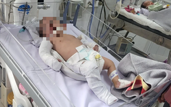 Bé gái 2 tháng tuổi bị bạo hành dã man đã được xuất viện