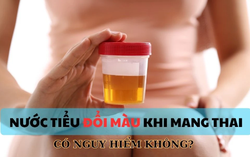 Nước tiểu bỗng đổi màu khi mang thai có nguy hiểm không?