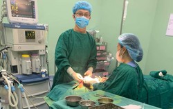 Bé trai 5 tuổi bị chó cắn nát vùng mặt