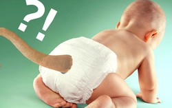 Tại sao một số người sinh ra có đuôi như động vật?