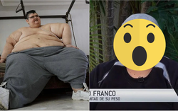 Chàng trai "béo nhất thế giới" từng nặng 575kg bây giờ ra sao sau phẫu thuật giảm cân?