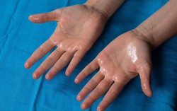 Mùa hè, cơ thể ra nhiều mồ hôi có phải là thải độc tốt hơn hay không?