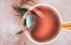Nguyên nhân gây đau hốc mắt và thời điểm cần gặp bác sĩ 