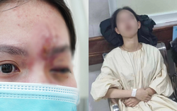 Tình trạng sức khỏe hiện tại của nữ sinh 17 tuổi bị mù mắt vì tiêm filler ở tiệm cắt tóc, gội đầu