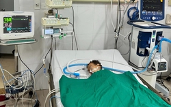 Số ca mắc sởi tăng mạnh, bệnh viện quá tải phải "cầu cứu" chi viện nhân lực