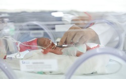 Phác đồ "giờ vàng": Cứu sống và giảm các nguy cơ biến chứng cho trẻ sinh non