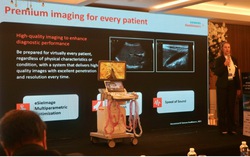 Siemens Healthineers ra mắt hệ thống siêu âm hoàn toàn mới với chi phí tối ưu 