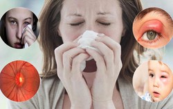 Tại sao viêm mũi xoang lại có thể gây mù mắt?