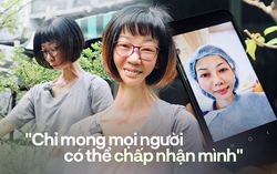 Bị mọi người xa lánh vì ngoại hình, người phụ nữ ở TP.HCM rớt nước mắt nói về khao khát hòa nhập cộng đồng 