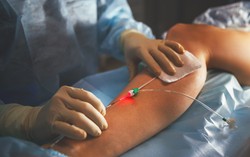 Tĩnh mạch nhân tạo hỗ trợ cấy ghép nội tạng