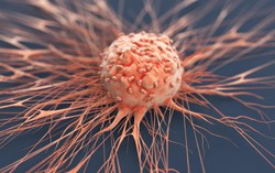 Cảnh báo: 6 chứng viêm nhiễm có thể phát triển thành ung thư nếu không điều trị và kiểm soát sớm