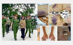 Người phụ nữ bị gia đình chồng cũ bạo hành dã man vì coi là "mầm họa" 