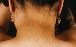 1 trong 4 bộ phận cơ thể chuyển sang màu đen có thể cảnh báo sức khoẻ đang gặp vấn đề