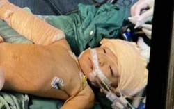 Bà mất sau tai nạn, bé trai 19 tháng tuổi nguy kịch cần sự giúp đỡ