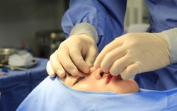 TPHCM: Liên tiếp sự cố y khoa thẩm mỹ, 1 phụ nữ tử vong
