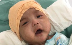 Ánh mắt cầu cứu của bé trai 5 tháng tuổi toàn thân lở loét vì căn bệnh quái ác