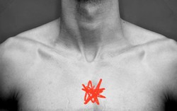 Đau xương ức có thể là dấu hiệu cảnh báo bệnh nghiêm trọng