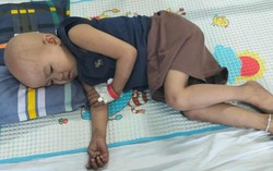 Chung tay níu sự sống cho bé gái 4 tuổi mắc căn bệnh quái ác