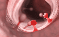 4 vị trí trong cơ thể dễ "mọc" polyp, lâu dần có thể phát triển thành ung thư