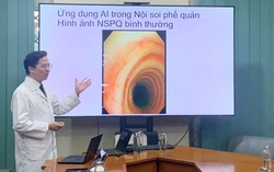 Ứng dụng trí tuệ nhân tạo phát hiện sớm ung thư phổi