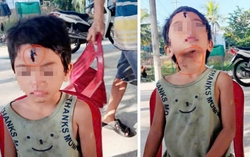 Kiên Giang: Chính quyền thông tin về vụ bé gái 6 tuổi nghi bị cha dượng bạo hành