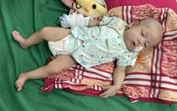 Thương cảnh mẹ nghèo lên mạng xin sữa cho con sinh non, dị tật bẩm sinh