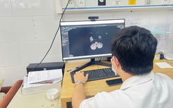 Thiếu niên 15 tuổi tổn thương não vì ngộ độc thuốc lá điện tử chứa chất độc thế hệ mới