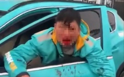 Tài xế xe ôm công nghệ bị đồng nghiệp đánh chảy máu mồm ở Hà Nội