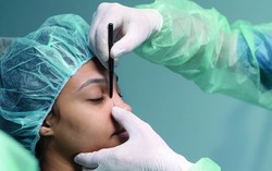 Ám ảnh cả đời sau phút "mềm lòng" vì chiêu trò thẩm mỹ