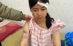 Cựu điều tra viên lý giải các tình tiết tăng nặng trong vụ bé gái 13 tuổi bị ông bà bạo hành