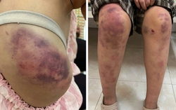 Vụ bé gái 13 tuổi bị ông bà bạo hành ở Thái Nguyên: Lời tâm sự xót xa của bà ngoại