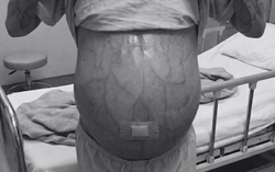 Hiểu lầm tai hại về ăn kiêng khiến nhiều người hoang mang