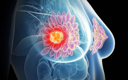 Hơn thập kỷ bền bỉ chống chọi ung thư vú nhờ 1 lời hứa của con