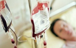 Số ca thiếu máu ở Việt Nam: Nữ tăng, nam giảm