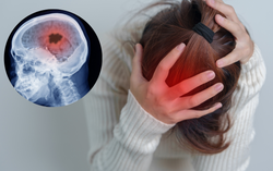 Phát hiện ung thư máu sau khi ngất lịm, đau đầu