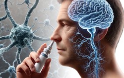 Thuốc nhỏ mũi trị ung thư não