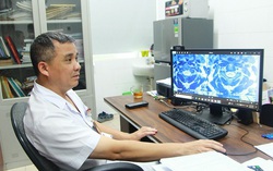 Dùng thử thuốc lá điện tử, nữ bệnh nhân 38 tuổi tổn thương não