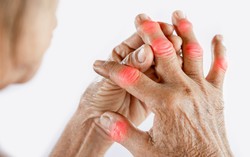 6 cách giảm đau tay do viêm khớp dạng thấp khi giao mùa
