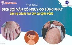 Đón xem Tọa đàm "Dịch sởi vẫn có nguy cơ bùng phát - cần sự chung tay của cả cộng đồng"
