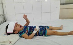Bé gái 3 tuổi phải trải qua 7 ca phẫu thuật giành lại sự sống