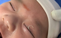 Hi hữu: Mẹ cắt móng tay văng vào mắt con 2 tháng tuổi