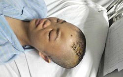 Mẹ suy thận giai đoạn cuối cầu xin sự sống cho con gái nguy kịch vì tai nạn giao thông