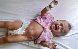 Ánh mắt cầu cứu của bé gái 6 tháng tuổi bị dị tật bẩm sinh, không tiền cứu chữa