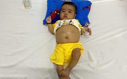 Ánh mắt cầu cứu của bé trai 7 tháng tuổi bụng to bất thường vì bệnh hiểm nghèo