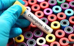 Không nên tự ý điều trị khi có dấu hiệu mắc Chikungunya 