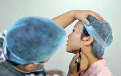 Phẫu thuật thẩm mỹ ở Trung Quốc: Thị trường 300 tỷ nhân dân tệ đang ngày càng trẻ hóa