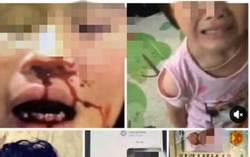 Hưng Yên: Xác minh vụ việc bé gái nghi bị bố bạo hành, ép gọi điện bảo mẹ "gửi tiền về"