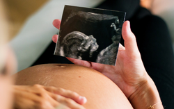 Hành trình giữ con của sản phụ bị cạn ối, xoắn dây rốn, tim thai dao động kém