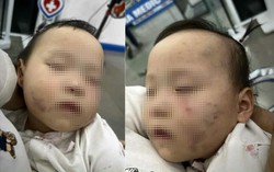 Xác minh, làm rõ vụ việc bé gái 1 tuổi bị thương khi đi học ở Bắc Ninh